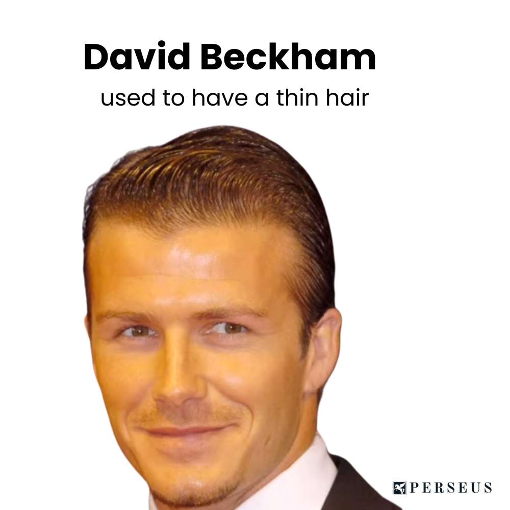 david beckham thin hair